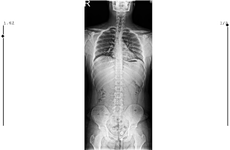 teletip_1774461097287.png